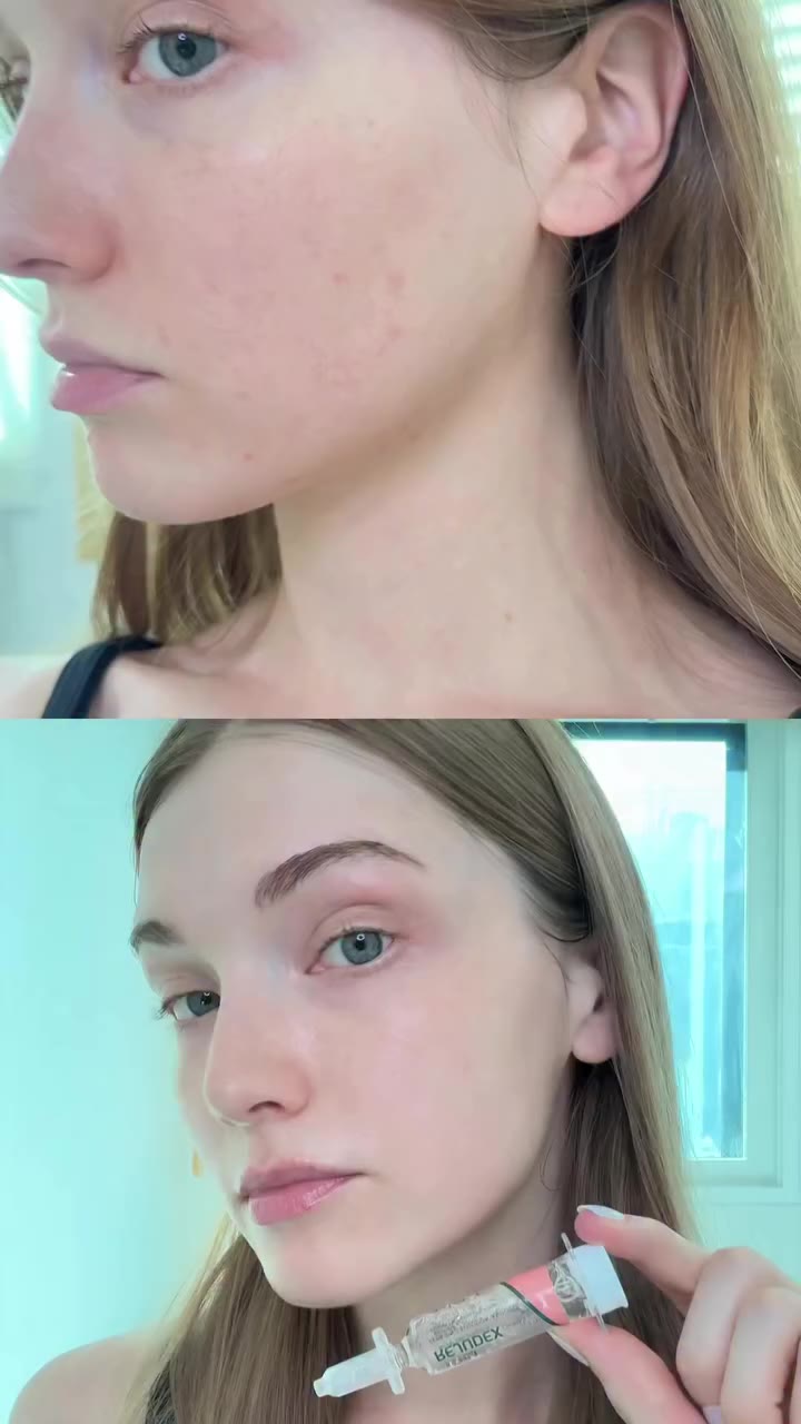REJUDEX Derma Repairing Solution Ampoule has become part of my post-care…