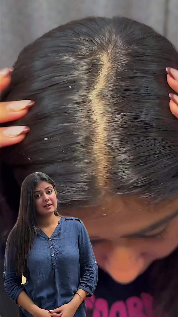 Healthy scalp. Better hair days. ✨🌿 Keep dandruff concerns in check with Kesh…
