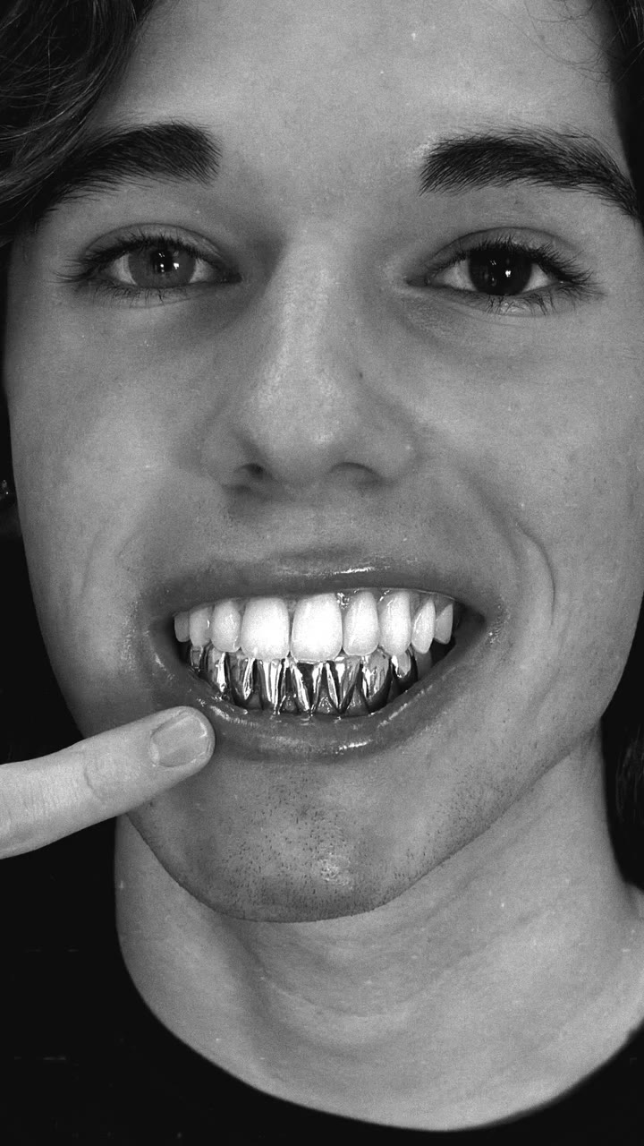 8 teeth White Gold perm cut bottoms Thank you! Matthew 🥶 #goldgrillz…