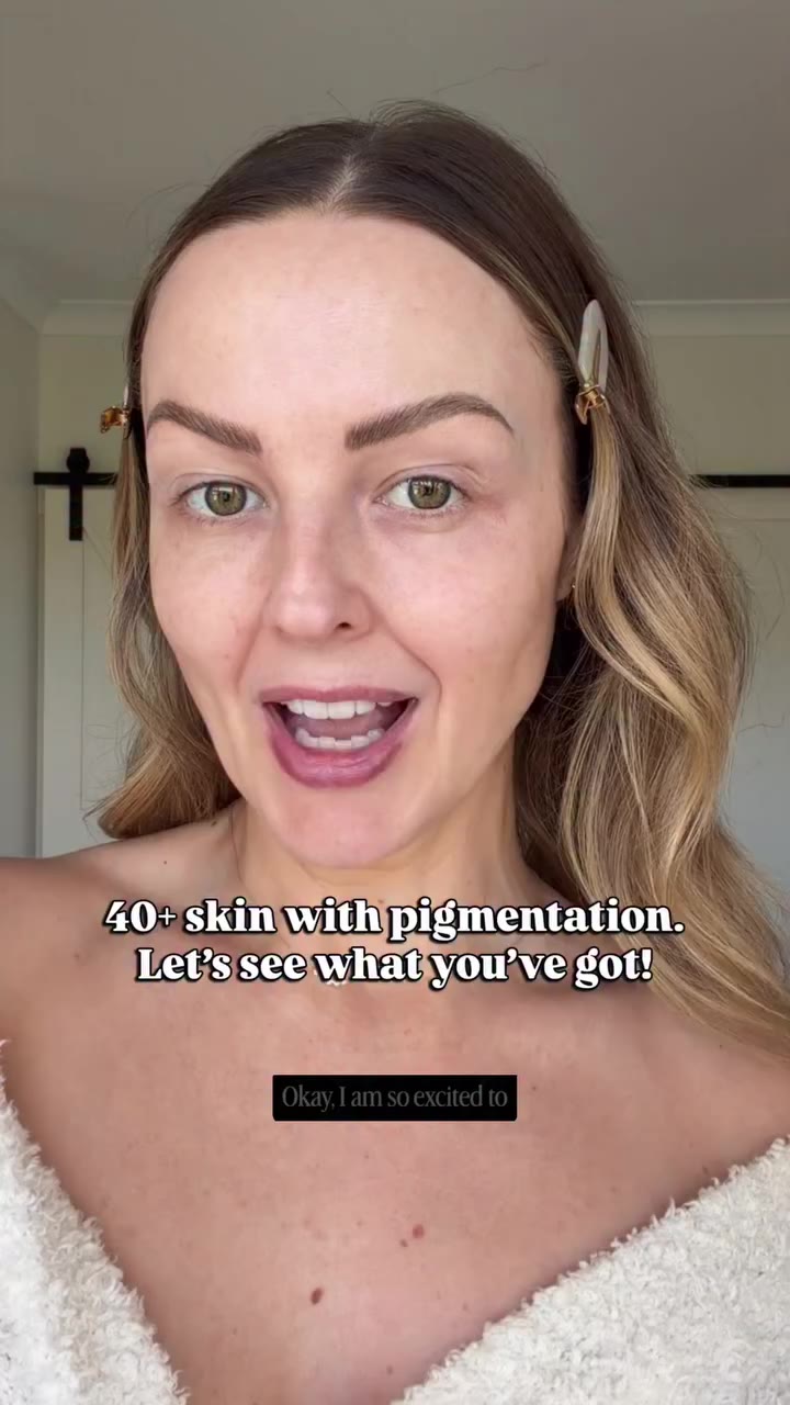 40+ skin, pigmentation AND a first impression… she had her work cut out for…